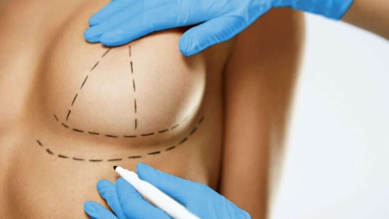 Precio levantamiento de senos Colombia 2024 2 precio levantamiento de senos colombia