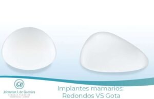 implantes anatómicos vs implantes redondos