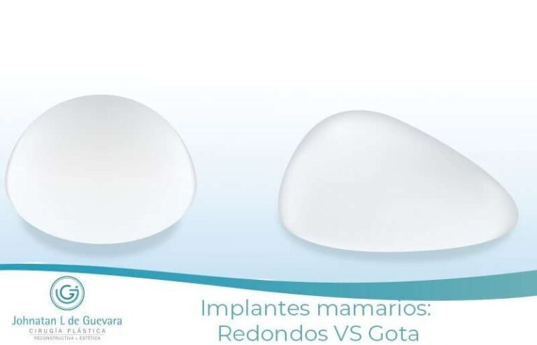 Implantes Mamarios Redondos vs Gota: ¿Cuál es la Mejor Opción para Ti? 1 implantes anatómicos vs implantes redondos