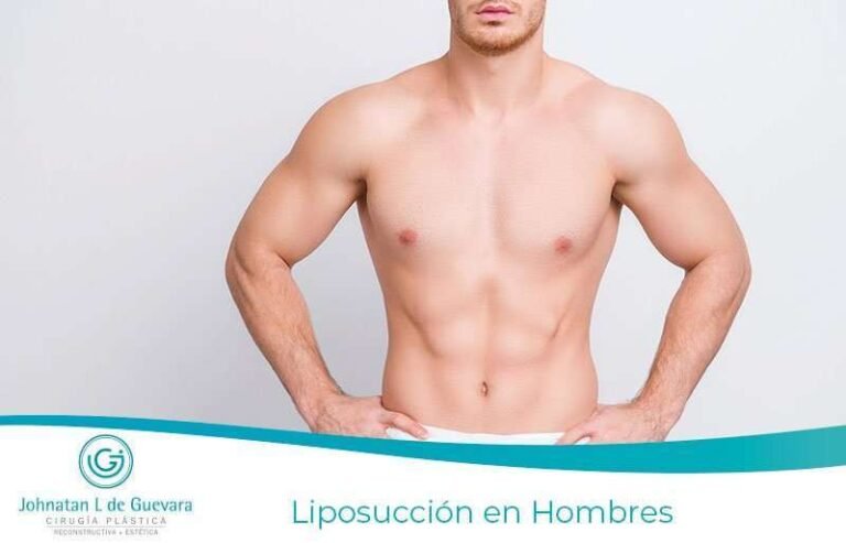 Liposucción en Hombres bogota