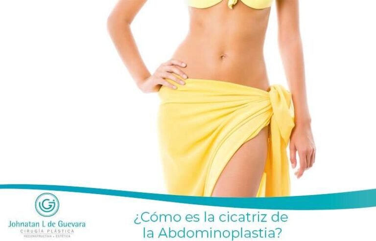 ¿Cómo es la cicatriz de la Abdominoplastia? 10 cicatriz de la Abdominoplastia