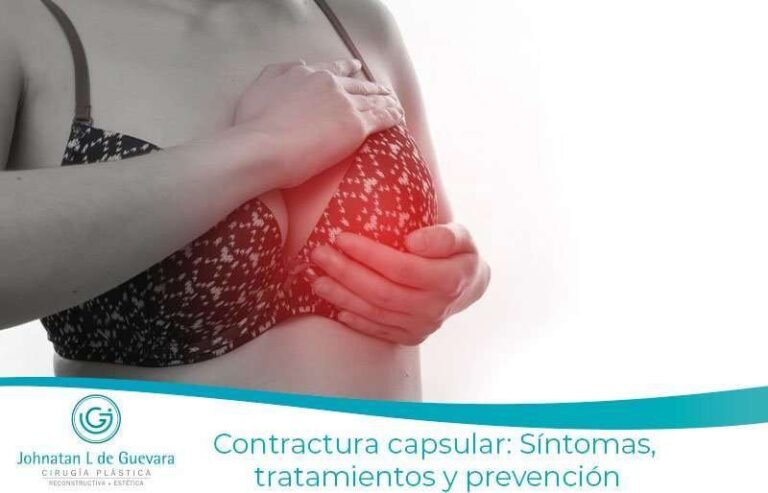 Contractura capsular: Síntomas, tratamientos y prevención 18 Contractura capsular: Síntomas, tratamientos y prevención