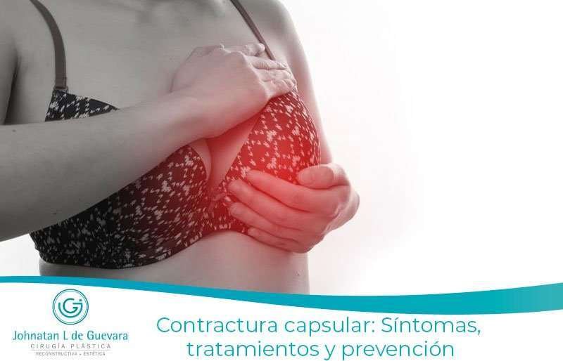 Contractura capsular: Síntomas, tratamientos y prevención