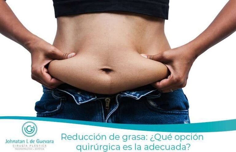 Reducción de grasa: ¿Qué opción quirúrgica es la adecuada? 17 Reducción de grasa: ¿Qué opción quirúrgica es la adecuada?
