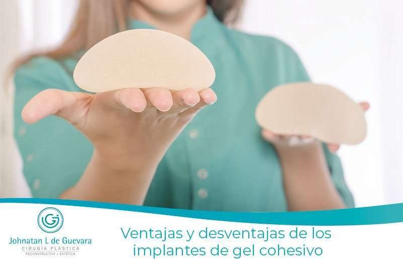 Ventajas y desventajas de los implantes de gel cohesivo