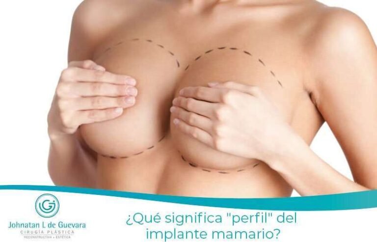 ¿Qué significa "perfil" del implante mamario? 20 ¿Qué significa "perfil" del implante mamario?