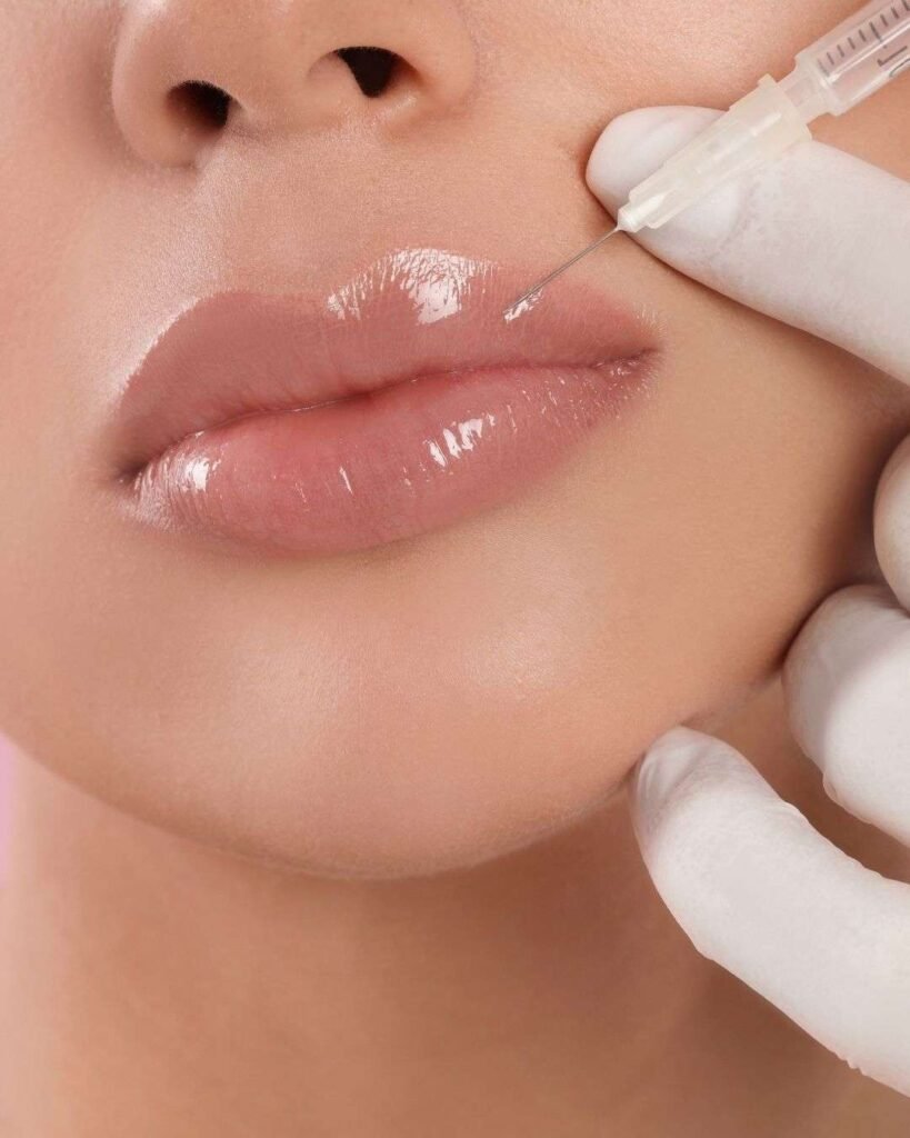 Aumento de Labios A - Aumento de Labios