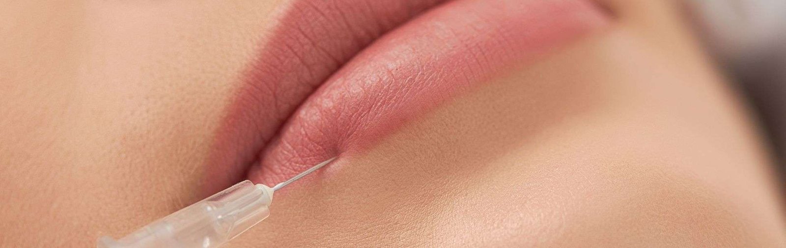 Aumento de Labios D - Aumento de Labios