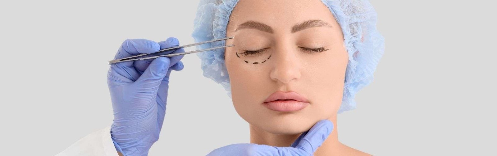 Blefaroplastia B - Blefaroplastia en Bogotá