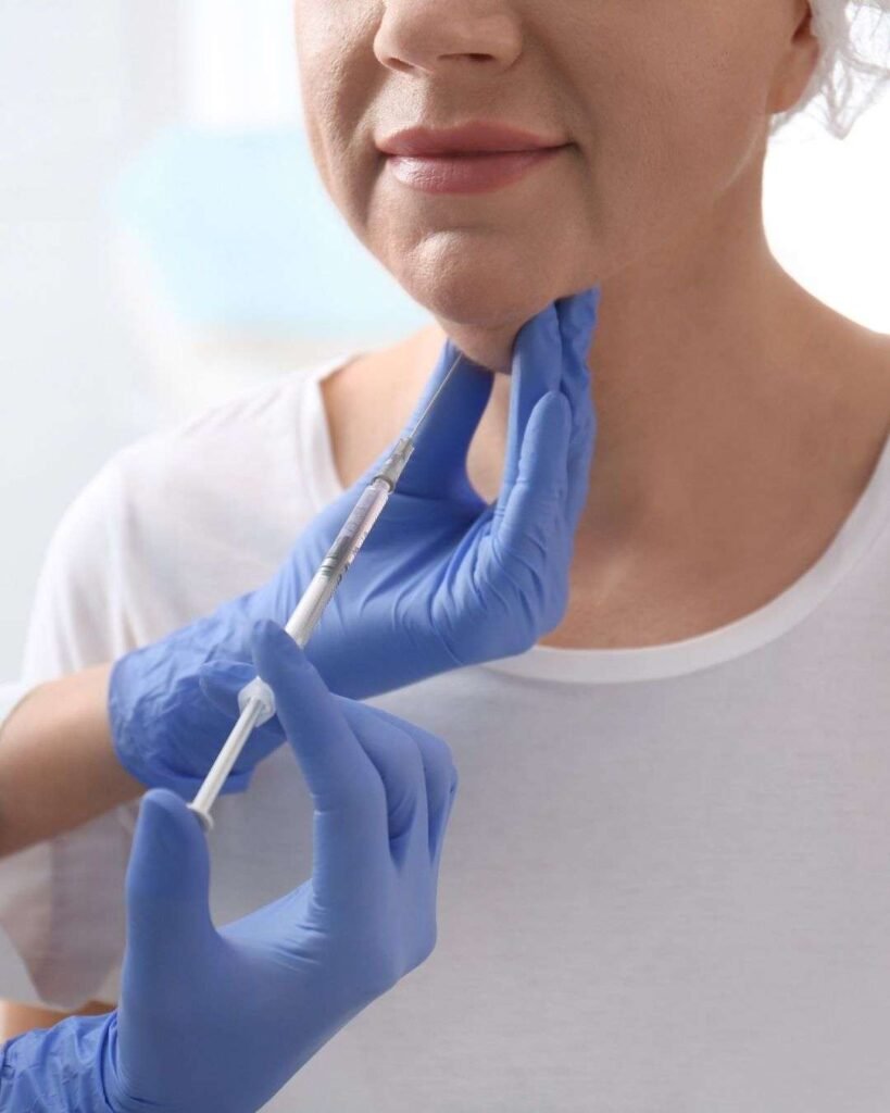 Lipopapada A - Chin Liposuction