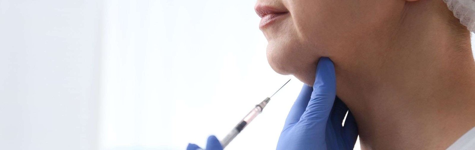 Lipopapada E - Chin Liposuction