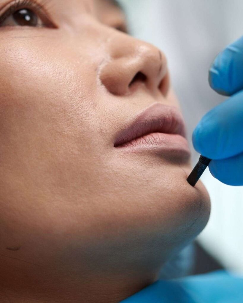 Mentoplastia A - Mentoplastia cirugía del mentón Bogotá