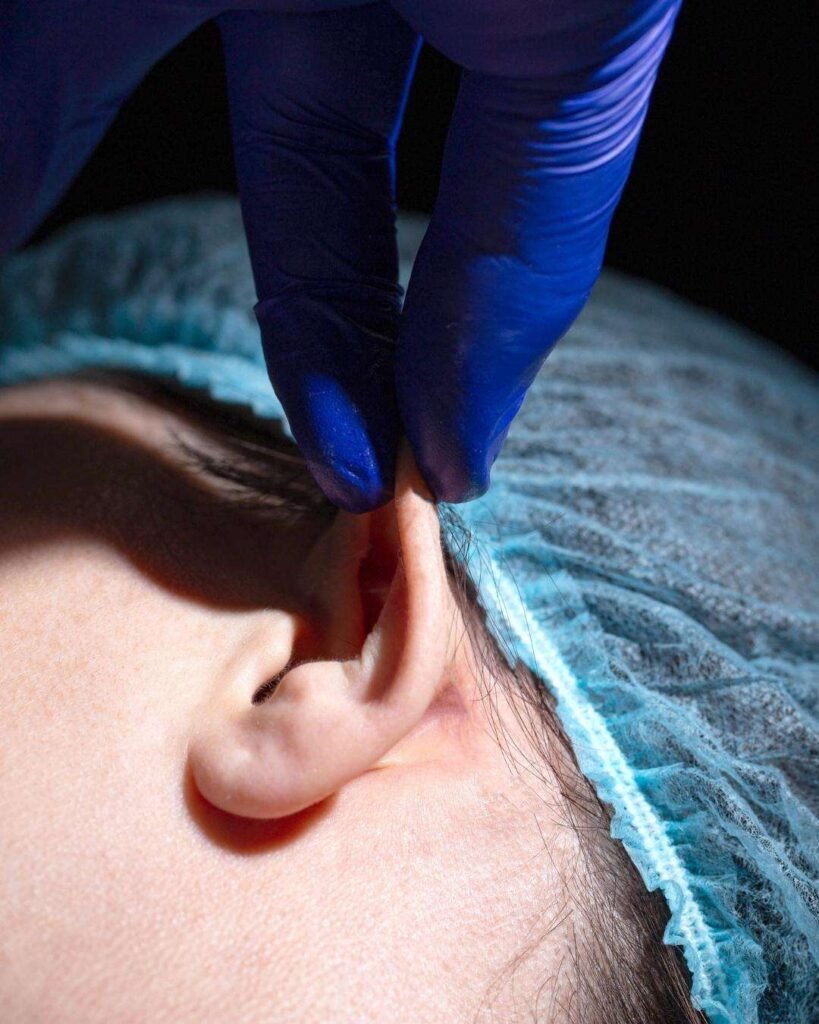 Otoplastia A - Otoplasty in Colombia