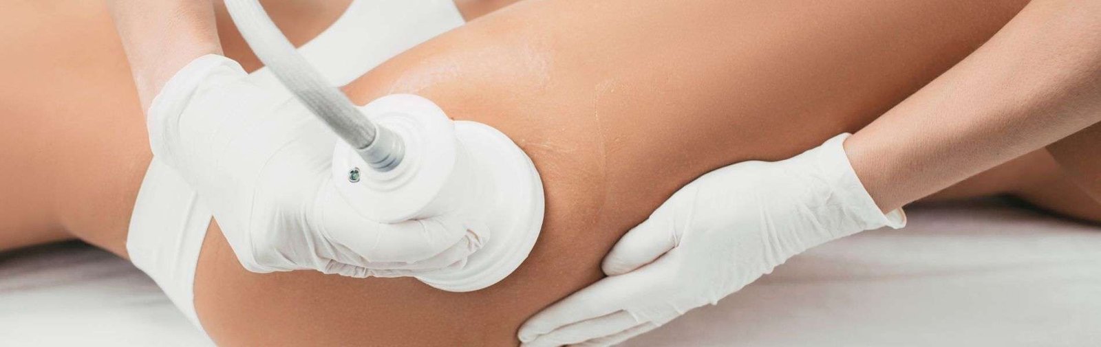 Tratamiento Celulitis E - Tratamiento para la celulitis